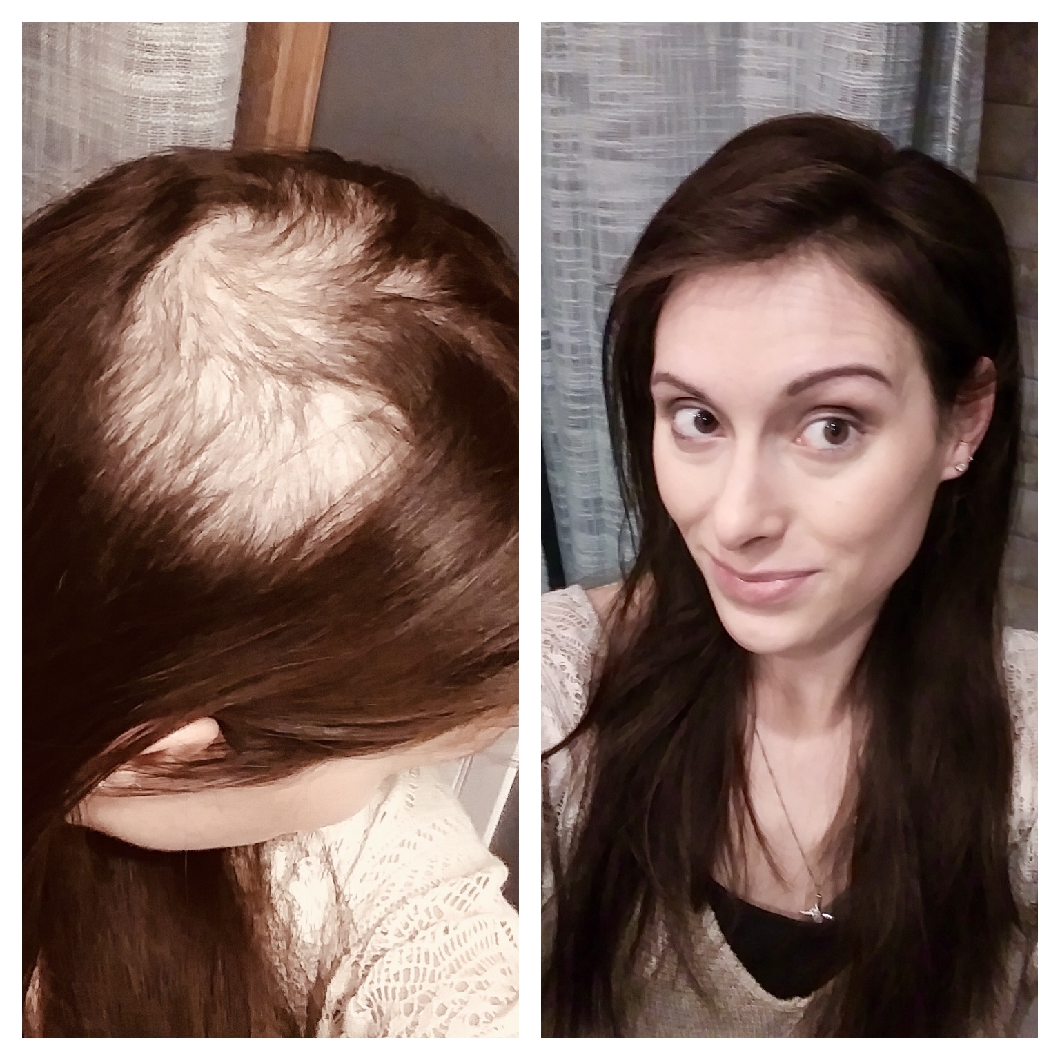 Trichotillomania solution