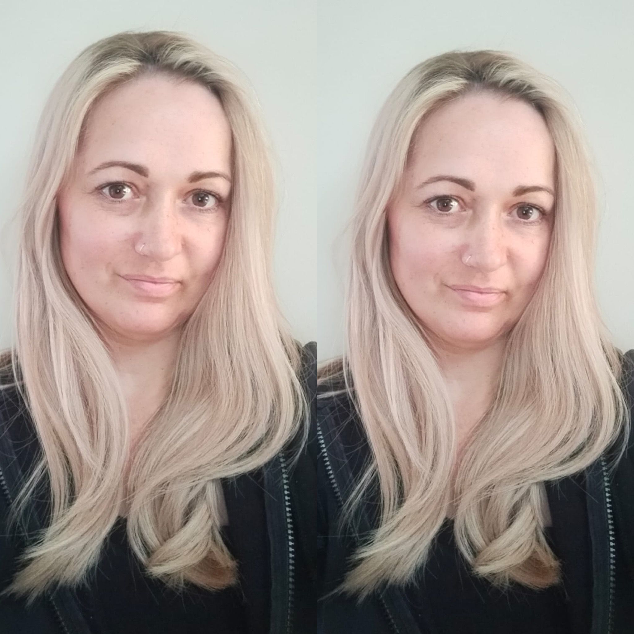 blonde hair topper with ombre shadow root natural hair loss