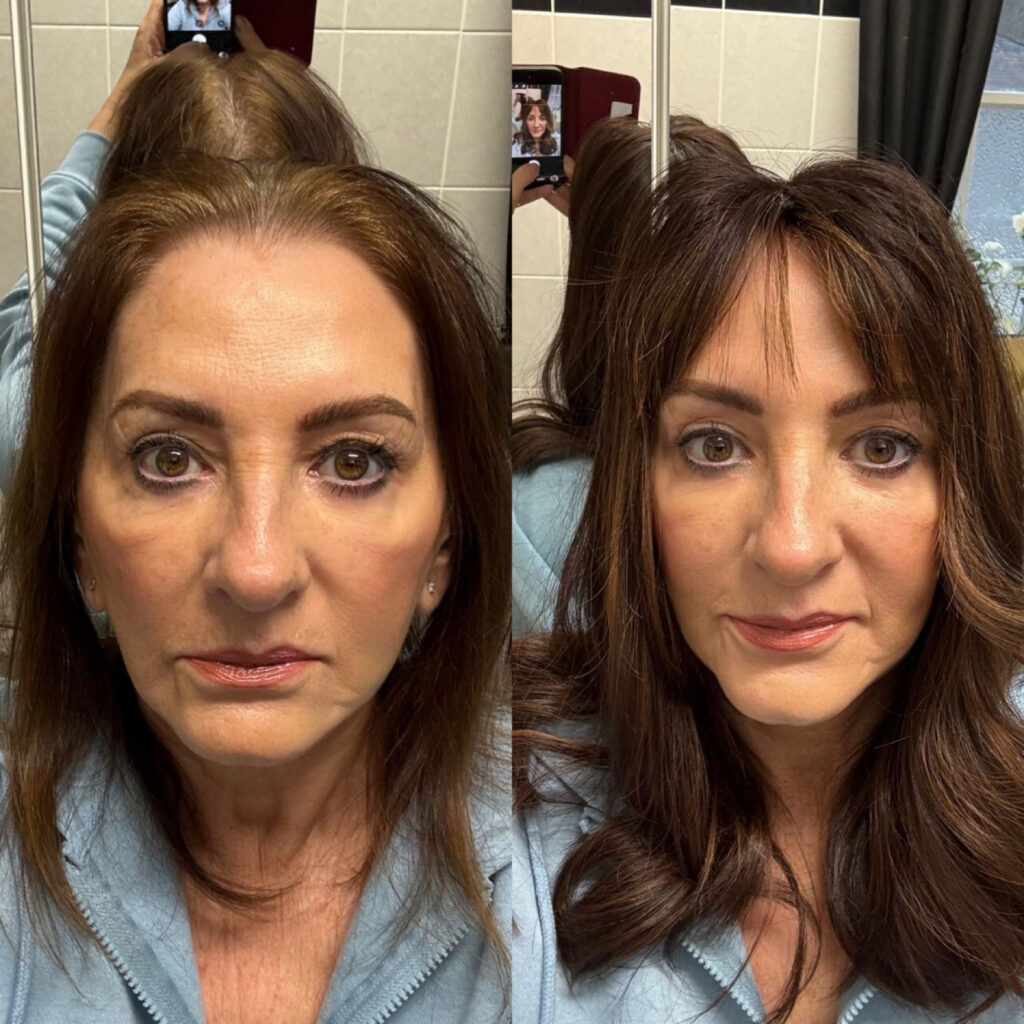 Clip in Hair Toppers for Hair Loss and Thin Hair