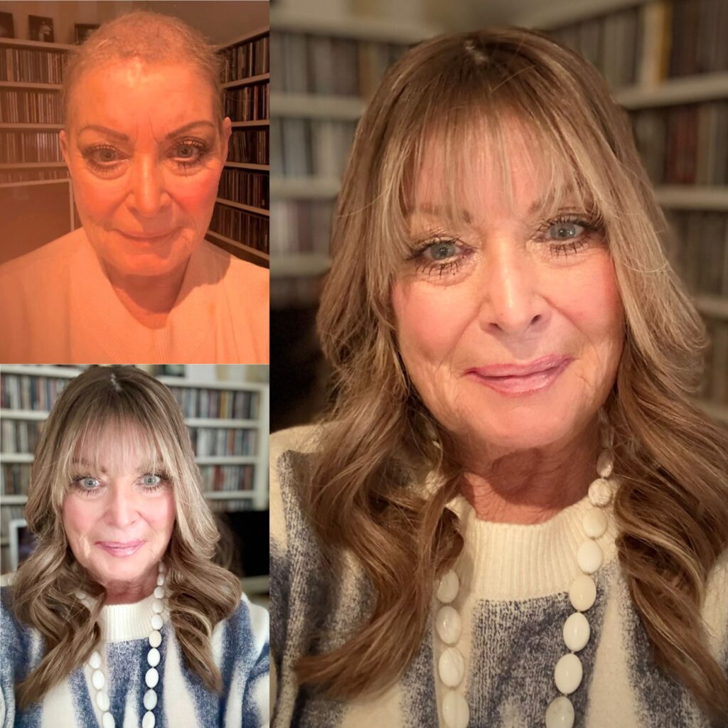 Post Chemo Wig Alternative