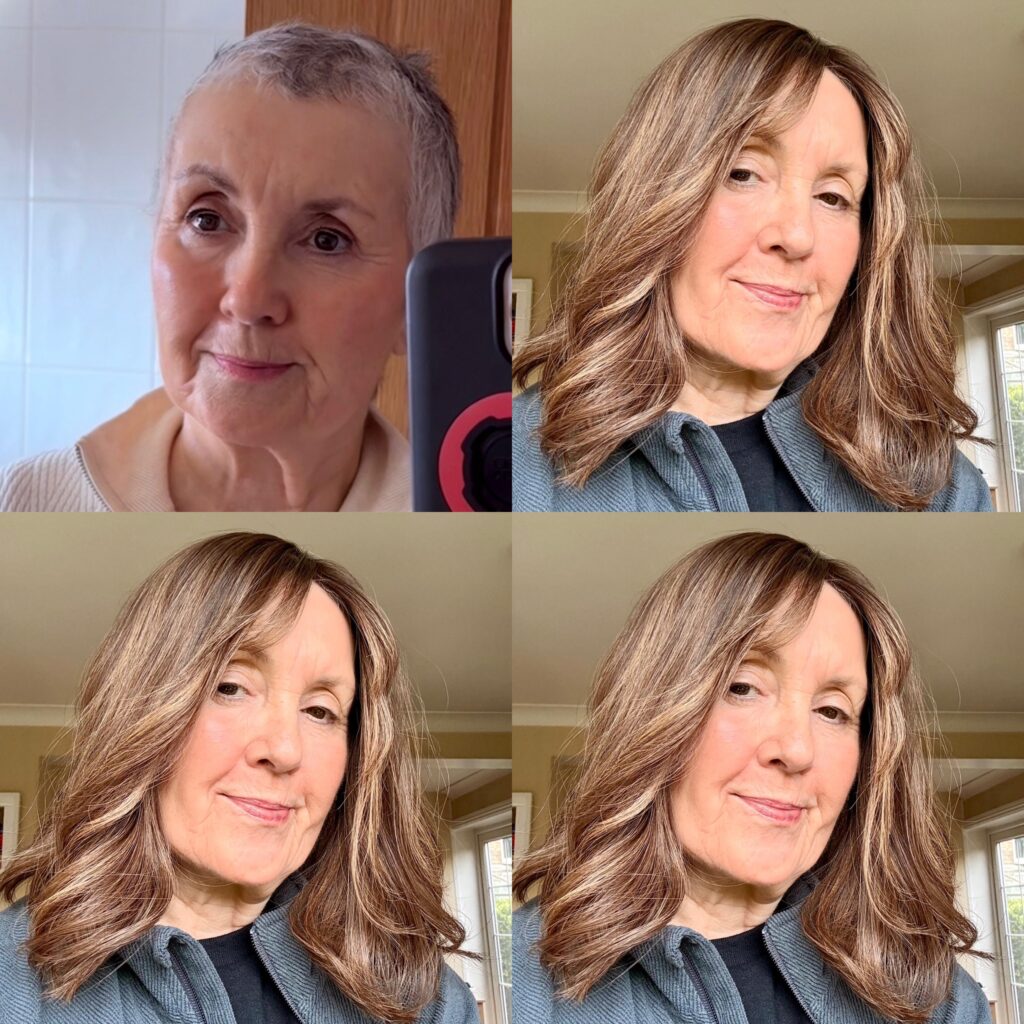 Chemo hair loss regrowth Perfectfringe hair topper the best