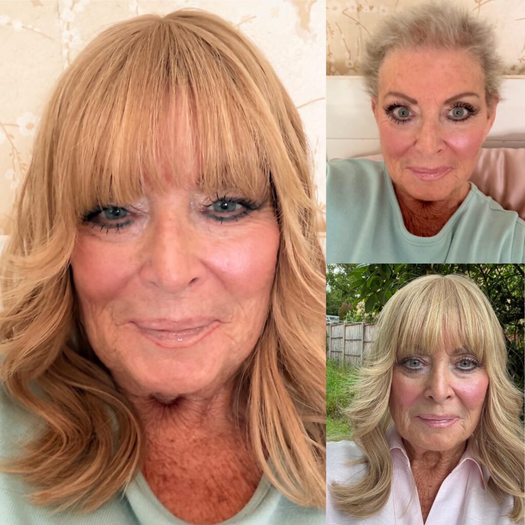 Post Chemo Regrowth hair wig alternative